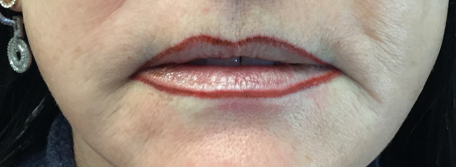 Permanent Lip Liner For Luscious Lips Enduring Esthetics